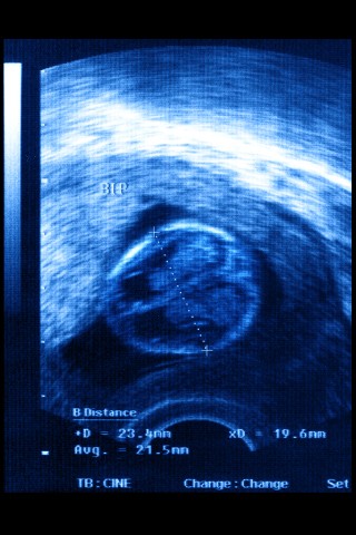 PovertyyoungBrain PovertyyoungBrain